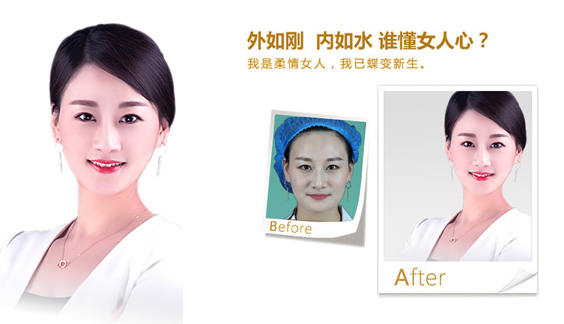 龙岩V脸、线雕隆鼻